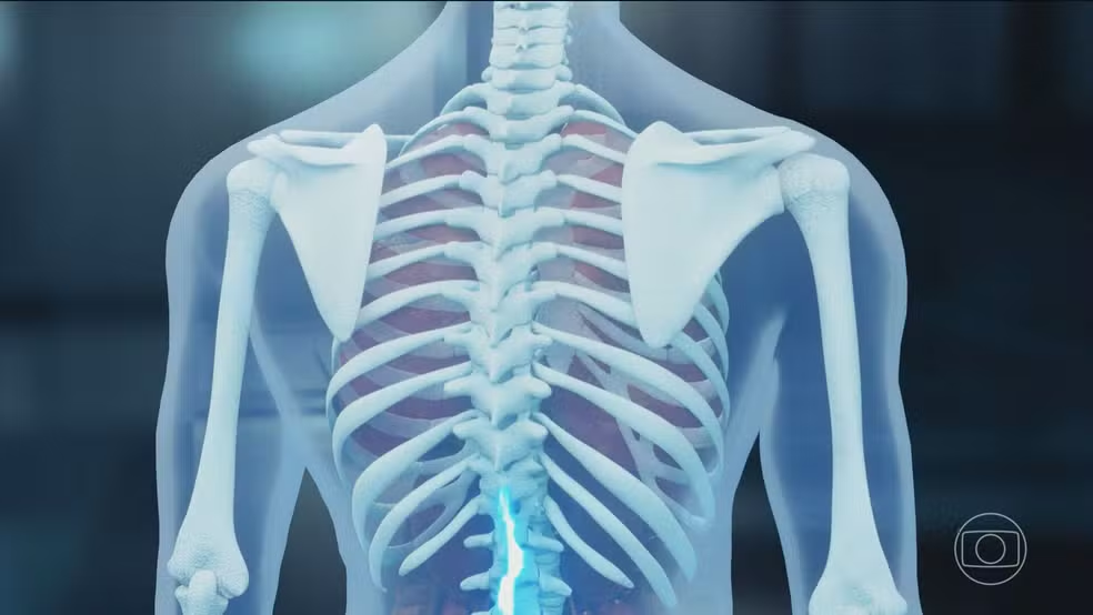 Polilaminina: 1ª cirurgia com proteína que pode recuperar movimentos após lesão na medula é realizada em MS